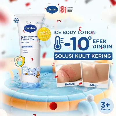 DEXTER Baby Turmeric Multi-Effect Ice Lotion 200gr | Solusi Kulit Ruam Kering Sensitif Biang Keringat | Body Lotion Bayi Anak dengan 5X Ceramide Sensasi Dingin | 5X Ceramide & Turmeric & Jojoba Oil - Skincare Bayi Skincare Anak
