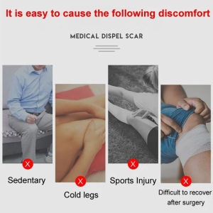 Knee Brace Joint Care Knee Support Cool Breathable Ultra-Thin Summer Air Conditioning Joint Guard Sports Protection Fitness Pain Relief Enhancement
