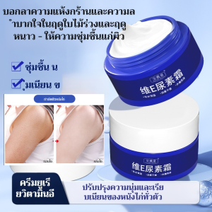 🔥Hot Sale🔥ครีมบำรุงผิววิตามินอียูเรีย ให้ความชุ่มชื้นอย่างล้ำลึกแก่ผิวแห้ง ปกป้องผิวจากความแห้งกร้าน แตก และแห้งกร้าน มอบความชุ่มชื้นและฟื้นฟูผิวแห้งกร้าน กักเก็บความชุ่มชื้นและบำรุงผิวอย่างมีประสิทธิภาพ