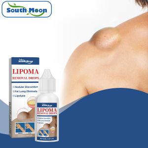 South Moon Lipoma Removal Drops Skin Swelling Relieve Drops 50ML