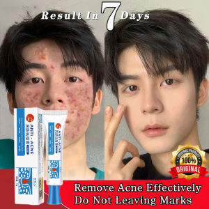 100% Effective Remove Pimples Anti-Acne Treatment Gel Scars Remover Repair Comedone Pimple Quick Acne Removal Cream Acne Repair Cream 25g