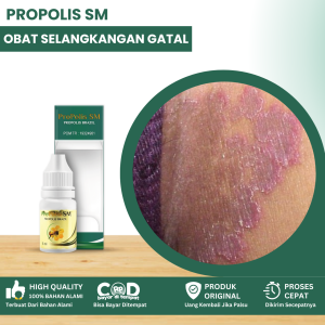 Obat Selangkangan Gatal Dan Hitam Obat Gatal Selangkangan Obat Jamur Selangkangan Obat Selangkangan Lecet Obat Kulit Bersisik Obat Selangkangan Lecet Ruam Dan Gatal Dengan Propolis SM