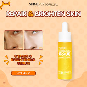 SKINEVER Vitamin C Brightening Serum Locks In Moisture Brightens Skin Moisturizes Skin Tone Whitening Hydration Essence Skin Care