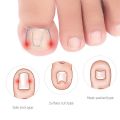 6Pcs Alat Korektor Kuku Kaki Cantengan / Toe Nail Ingrown Pedicure / Nail Corrector / Alat Koreksi Kuku Kaki Tumbuh Ke Dalam. 