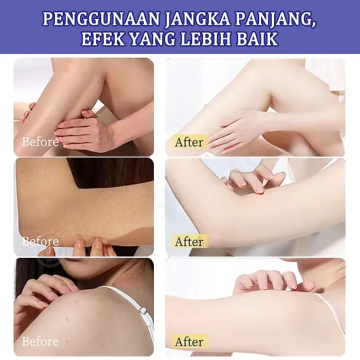 Sumifun%20Beauty%20%20Body%20Lotion%20Healthy%20Whitening%20Body%20Lotion%20With%20Glutathione%20%20Hydrating%20Anti%20Aging%20Smoothing%20Brightening%20Skin%20Whitening%20Body%20Lotion%20400ml,vitamin%20E%20-%20Image%207