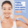 NIVEA Face Care Acne Repair Spot Serum Treatment with Salicylic Acid, 15ml. 