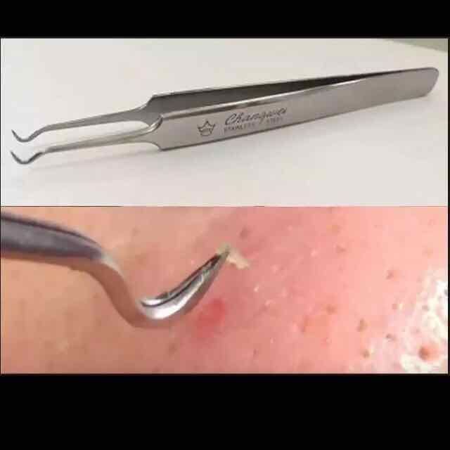 %5BHCM%5DNhi%E1%BA%BFp%20G%E1%BA%A5p%20M%E1%BB%A5n%20C%C3%A1m%20-%20Image%201