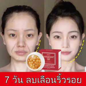 30ชิ้นไฮยาลูโรนิคแคปซูลเซรั่มต่อต้านริ้วรอยต่อต้านริ้วรอยสารสกัดเพิ่มความชุ่มชื้นจุดสิว Remover ไวท์เทนนิ่งครีม ผลิตภัณฑ์ดูแลผิวหน้า