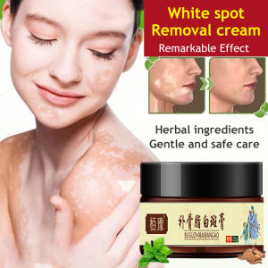 aomulei 20g Herbal Essence Vitiligo Treatment Cream Skin Care Cream