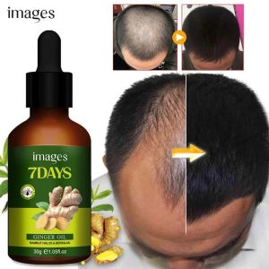 FREE ONGKIR Cindynal Ginger Oil Clothes of Skin 7 days Minyak Penumbuh Rambut Botak Rontok Pria Anak Bayi Balita Cepat Serum Essence Penghitam Uban Penyubur Rambut BPOM