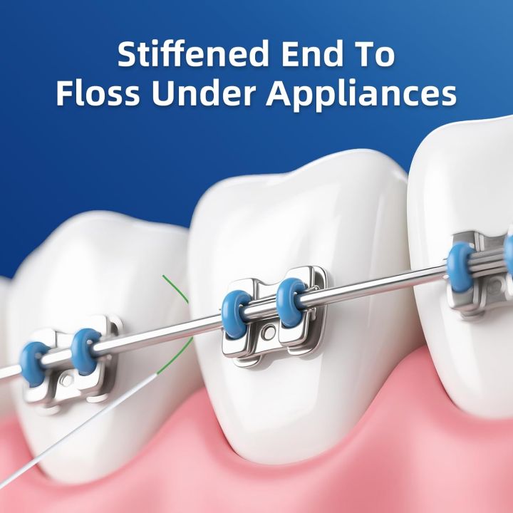 RioRand%203-in-1%20Dental%20Floss%20for%20Braces%20-%2080%20Pre-Cut%20Strands%20with%20Floss%20Threaders%20%7C%20%20%20Orthodontic%20Floss%20for%20Effective%20Cleaning%20160%20Count%20(Pack%20of%202)%20-%20Image%202