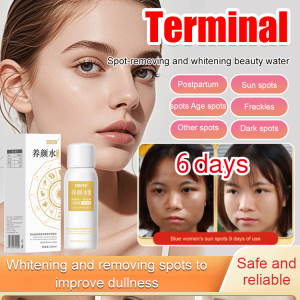 【6-Day Jade Face】 Whitening beauty water Whitening essence Blemish remover Acne scar repair water Quick acne removal Gentle whitening Deep cleansing Oil control and moisturizing Brighten skin tone Tighten pores