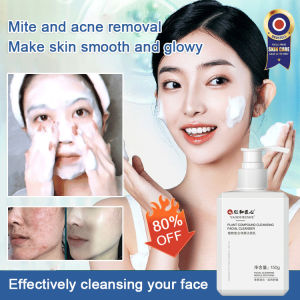 Lonice Store Amino Acid Cleanser Gentle Moisturizing Removes Mites and Controls Oil