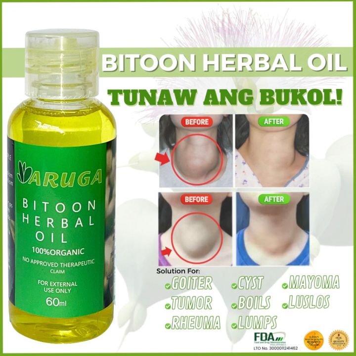 Aruga Bitoon Herbal Oil 60ML For Bukol Original BITOON PURE EXTRACT SEA ...