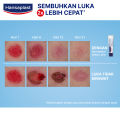 Hansaplast Salep Luka 20gr. 