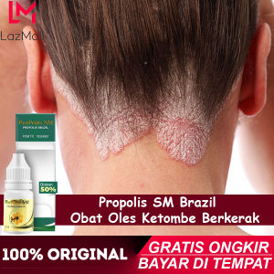 Obat Ketombe Parah - Mengobati Ketombe Berkerak Obat Pembersih Ketombe Berkerak Obat Ketombe Berkerak Obat Kulit Kepala Bersisik Obat Psoriasis Obat Ketombe Berkerak dibelakang kepala Dengan Propolis SM Brazil