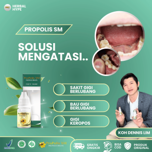 Obat Sakit Gigi Berlubang Obat Sakit Gigi Dan Gusi Obat Gusi Bengkak Linu Ngilu Bernanah Obat Penghilang Karang Gigi Obat Nyeri Gigi Anak & Dewasa Obat Gusi Luka Obat Gusi Bernanah Obat Gusi Bengkak Nyut Nyutan  Obat Polip Gigi - Propolis SM