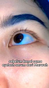 MARWAH EYELASH SERUM BULU MATA MENEBALKAN MENGUATKAN BULU MATA