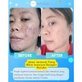 HARUKA Skincare untuk Kulit Flek - Haruka Skincare Official. 