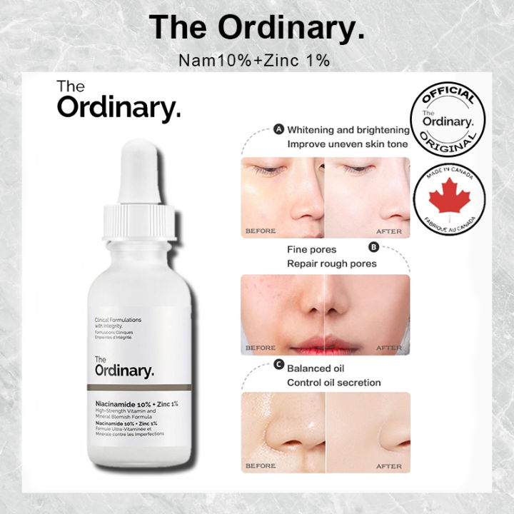 The Ordinary Niacinamide 10%+Zinc 1% serum face essence universal serum for blemish-prone skin that smooths, brightens improves skin smoothness and reinforces the skin barrier