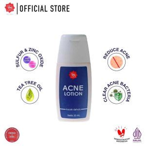 [BPOM] VIVA Acne Lotion with Sulfur Tea Tree Oil and Zinc Dioxide Reduce Acne Clear Skin - 30ml