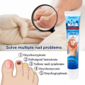 💯✅ SUMIFUN NAIL FUNGUS TREATMENT CREAM Fungal Nail Removal Onychomycosis Paronychia Anti Fungus Infection Toe Nail Nourishing Brightening Hand Foot Nail Antibacterial Care 💯✅. 