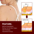 H Wart Removal Liquid Pen/Mole removal care pen 3ml. 