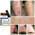 Japan Penghilang Bekas Luka Scar Cream Removal Krim Penghilang scar keloid bopeng bekas luka lama dan baru Old Scar Remover Gel Repairs Whole Body Scars Stretch Marks Pockmarks and Acne Marks 30g. 