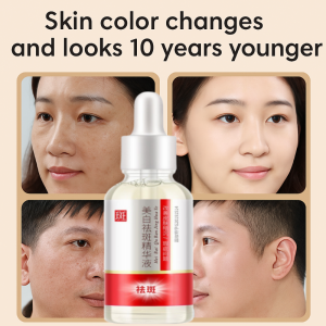Brightening Spot Correcting Serum Whitening Anti-Freckle Essence Skin Treatment Niacinamide Essence Liquid