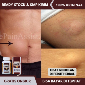 Obat Benjolan di Perut Penghilang Benjolan di Perut Solusi Kelenjar Getah Bening di Tubuh Obt Lipoma Leher Ketiak Selangkangan Kepala Penghancur Pengecil Lipoma Keras Limfoma Menonjol Sakit Buat Anak Dewasa Obat Hilangkan Uci Uci Dengan Walatra B