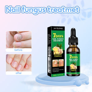 Jaysuing เซรั่มดูแลเล็บขิง7วันปรับปรุงความเสียหายเสริมสร้างการดูแลเล็บ30มล
