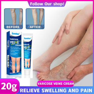 Kem bôi suy giãn tĩnh mạch hiệu quả nội địa Trung，giúp lưu thông tĩnh mạch phục hồi hiệu quả các mạch máu bị sưng ở tay và chân giảm đau Suy tĩnh mạch Sửa chữa chỗ gân xanh ở chân giun đất/20g