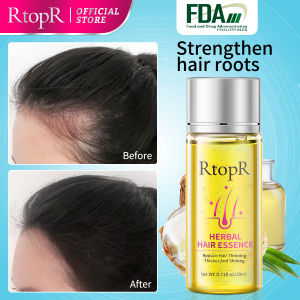RtopR Herbal Hair Growth Anti Hair Loss Liquid Promote Thick Fast Hair Growth Treatment 20ml Essential Oil Health Care Beauty Essence