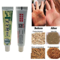 Zudaifu antibacterial cream for itchy and skin disease like allergy, dermatitis, psoriasis, eczema, antifungal treatment. 