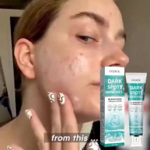 ครีมปรับผิว 1EELHOE  ครีมบำรุงผิวสูตรเข้มข้น ให้ความชุ่มชื้น จางเลือนจุดด่างดำและสิวเสี้ยน ปรับสีผิวให้กระจ่างใส ผิวนุ่มเด้ง และเปล่งปลั่งอย่างเป็นธรรมชาติ