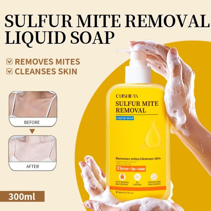 Body%20Wash%20Psoriasis%20Eczema%20Anti%20acne%20Mite%20Remove%20Moisturizing%20SulfurMite%20Removal%20Shower%20Gel%20-%20Image%202