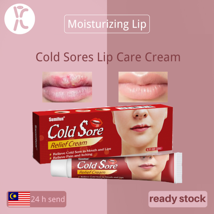 20g Cold Sores Lip Care Cream Repair Cheilitis Lips Herpes Ulceration