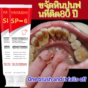 Probiotic Whitening and Stain-Removing Toothpaste Remove Tartar Plaque Gingival-protecting and Fresh Tone Toothpaste