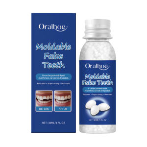 Oralhoe Solid Toothpaste Modified Teeth Temporary Filling Holes Filling Toothpaste Dentures Interdental Filling Toothpaste