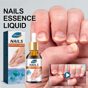 Ximonth Nail Fungus Treatment Essence Liquid Nail Serum Repairs Damaged Nails Pengobatan Onikomikosis 30ml
