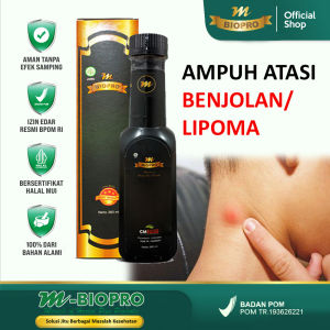 Obat Penghilang Benjolan di Tubuh Ampuh - Obat Benjolan di Leher - Obat Benjolan di Tangan - Obat Benjolan Lipoma - Obat Benjolan di Tubuh - Obat Benjolan di Miss V - Obat Benjolan di Kepala - Obat Benjolan di Selangkangan Mbiopro Herbal Asli Original