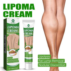 OUHOE  Fat Removal Cream   Body Care Cream for Dissolving Various Fat Clots and Subcutaneous Lumps