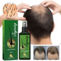 Jaysuing Green Ginger Hair Growth Spray Serum Natural Anti Hair Loss Products Fast Growing Treatments Germinal Liquid For Men Women. 