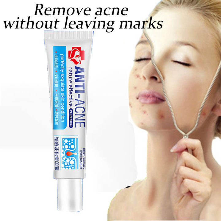 Original Acne Scars Remover For Face Pimples Remover Best Seller Scar Gel Pimple Quickly Marks 8712