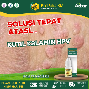 Propolis SM Obat Kutil Kelamin HPV Obat kutil anus pria / wanita penghilang kutil kelamin Perontok Kutil kelamin Herbal Penghilang Daging Tumbuh di Kelamin Obat kutil Kelamin Pria Obat benjolan di kelamin Parah dan Gatal