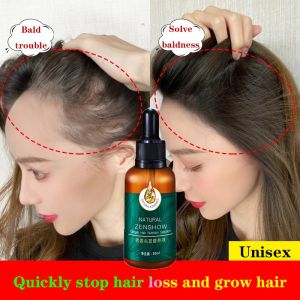 100% Natural Ginger Hair Serum Hair Grower Fast Long Hair Treatment Minoxidil Hair Grower Castor Oil For Essence Preventing Baldness Consolidate Hair Loss Treatment repairs the hair improves hair loss hair growth serum 10 x faster