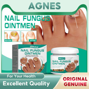 South Moon Nail Fungus Treatment Cream Removal Onychomycosis Paronychia Anti Infection Foot Toe Fungal Grey Nails Repair Feet Care Cream Effective Nail Treatments Cream Nail Fungus Removal Cream Paronychia Soft Nail Toenail Repair Ointment(20g)