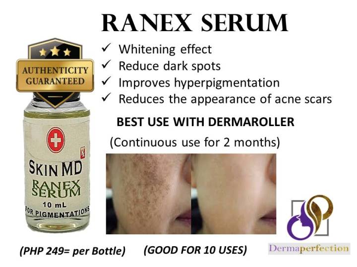 RANEX SERUM FOR HYPERPIGMENTATION, PEKAS, DARK SPOTS Dermaperfection ...