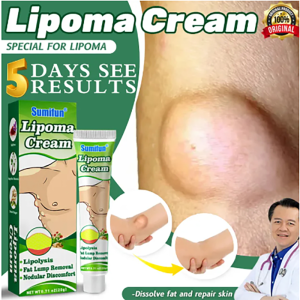 Lipoma Removal Cream lipoma Gel Removing Multiple Single Lipoma Subcutaneous Lipoma Lump Bulge Body Hard Block Nodular Tumor Skin Swelling 20g