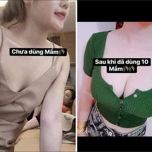 6%20H%E1%BB%99p%20K%E1%BA%B9o%20M%E1%BA%A7m%20L%C3%BAa%20M%E1%BA%A1ch%20Gold%20Th%E1%BA%A3o%20M%E1%BB%99c%2037%20-%20Image%204